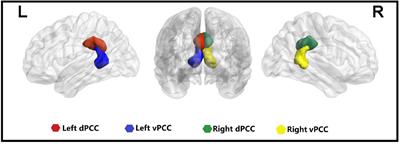 Aberrant Dynamic Functional Connectivity of Posterior Cingulate Cortex Subregions in Major Depressive Disorder With Suicidal Ideation